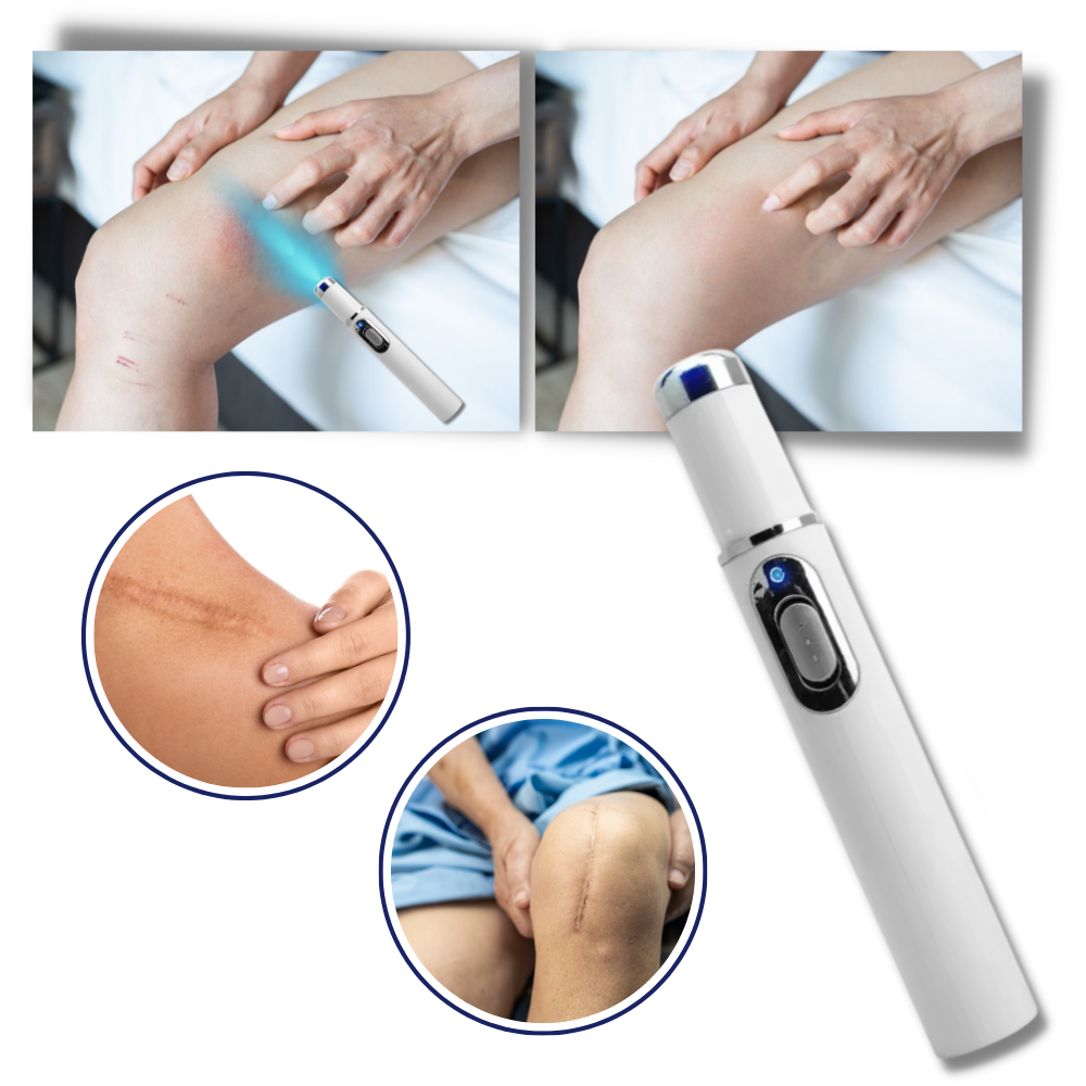 DermaPure | Thérapie laser portable pour un teint plus lumineux