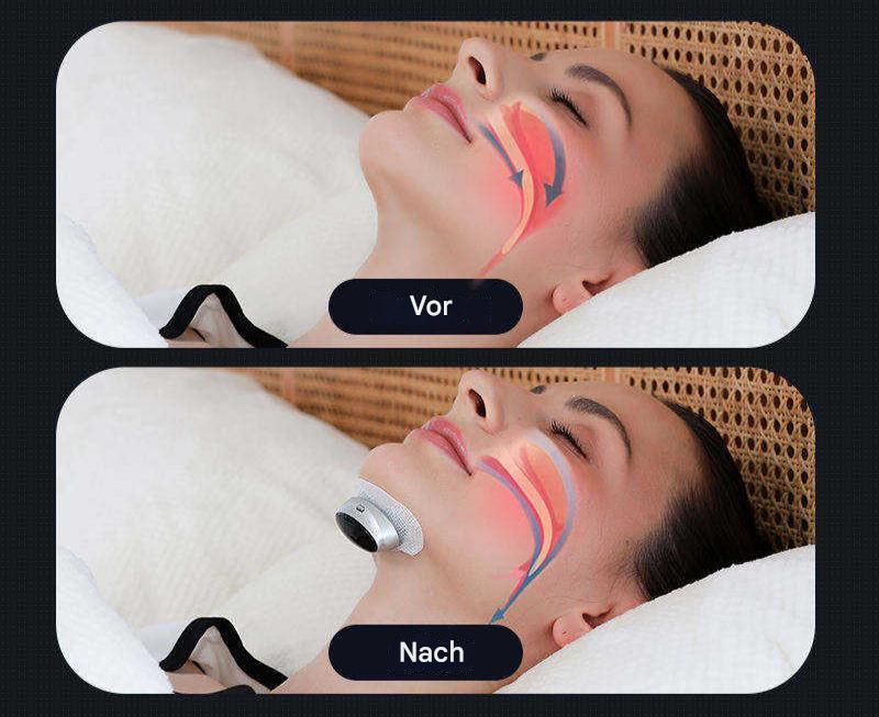 Dispositif d'apnée du sommeil - AirEase